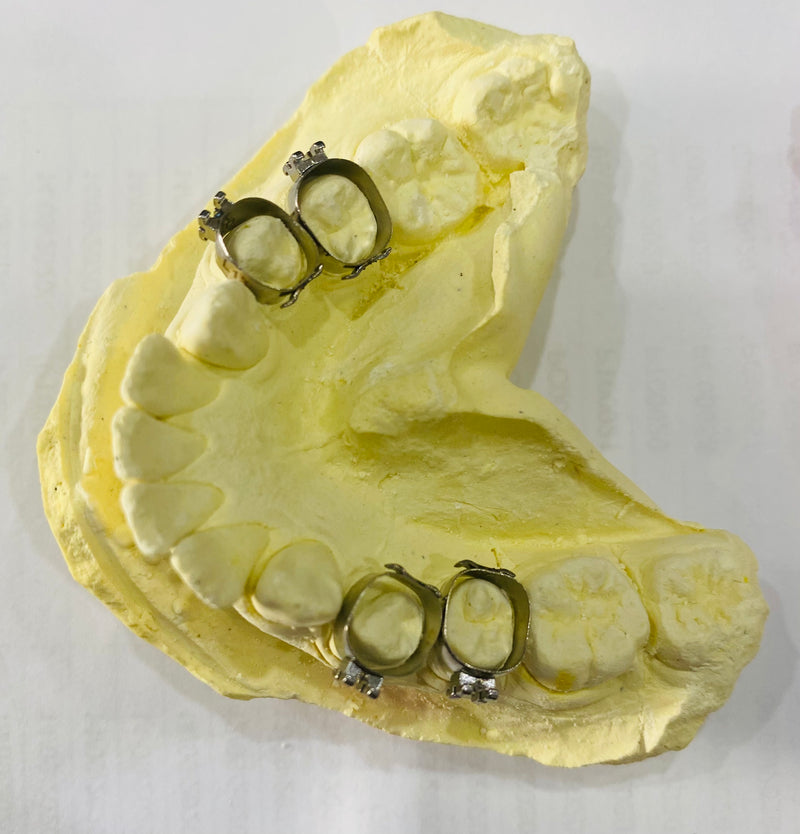 Khâu đơn răng 4, răng 5 - Ortho Technology