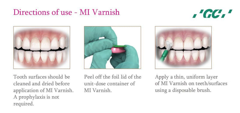 mi-varnish---vecni-fluor-bảo-vệ-răng-&-phòng-ngừa-sâu-răng-49p.vn